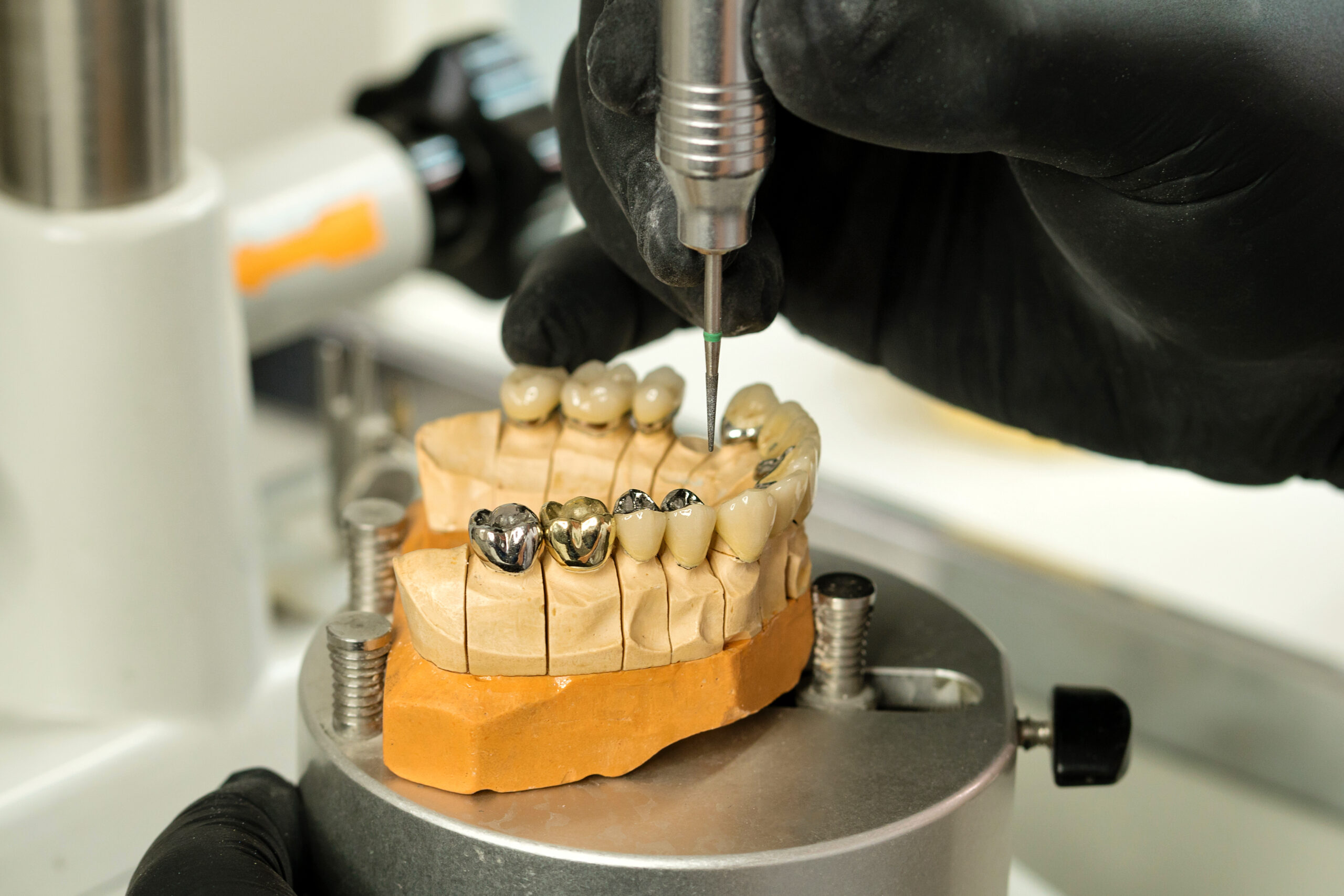 Manufacturing of dental crowns and dentures. Crown milling on High precision milling machine. Prosthodontic work