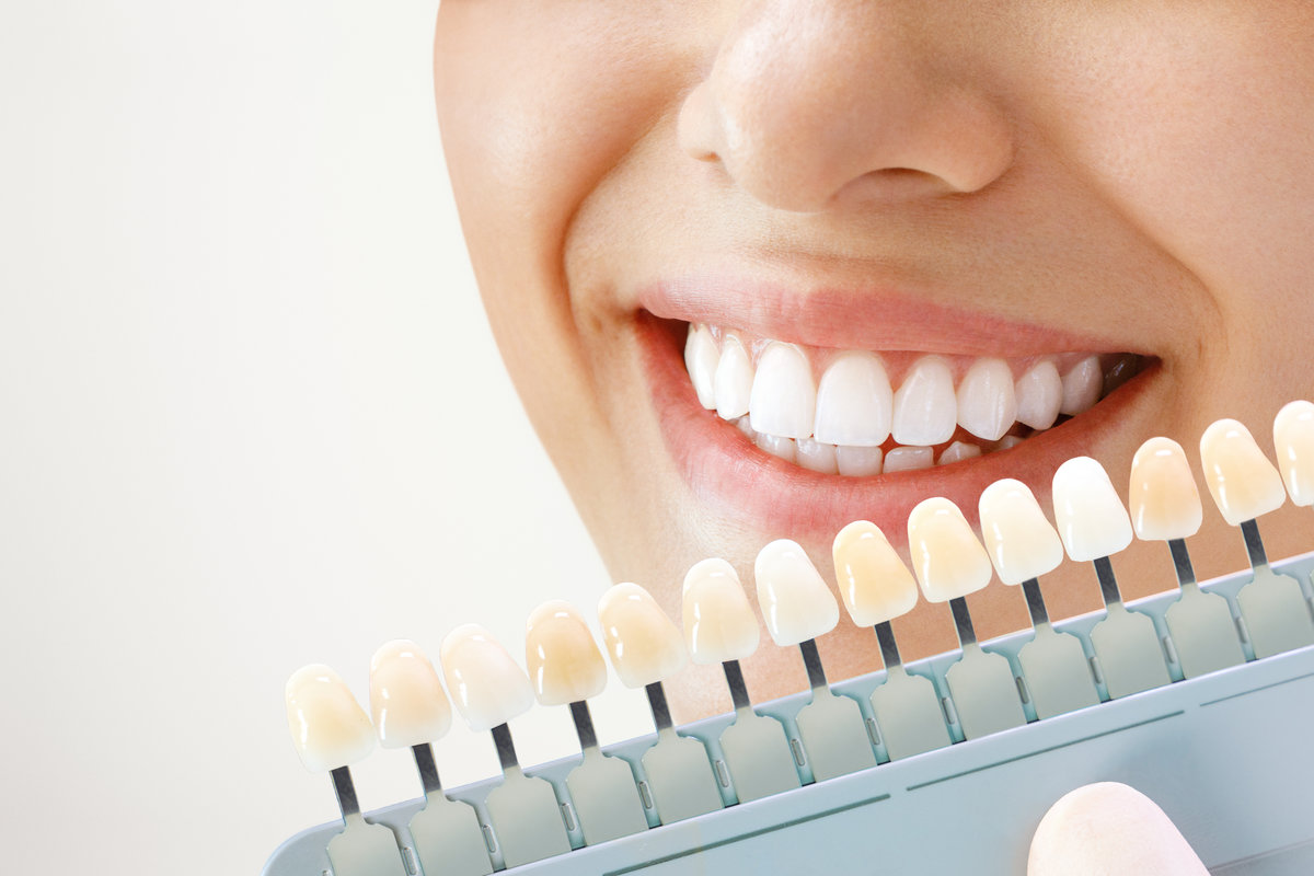 Smiling young woman. Cosmetological teeth whitening in a dental clinic. selection of the tone of the implant tooth.